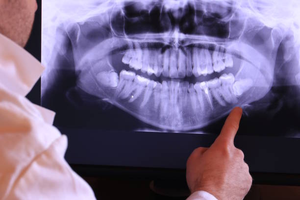 Best Orthodontic Emergency Dentist in Hunter, OH